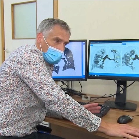 Professor Gisli Jenkins examining scans of the lungs 