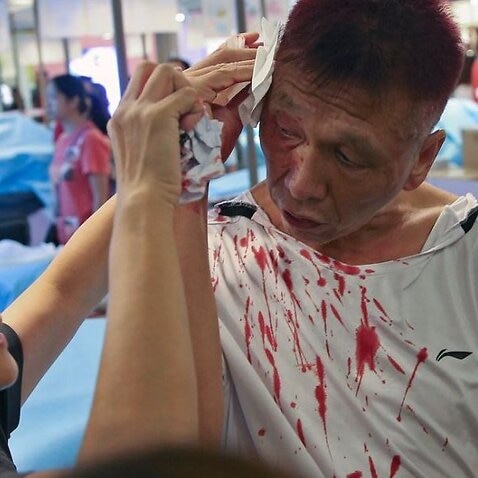 A man bleeding from a head injury is assisted by a woman after anti-government protesters and pro-China supporters clashed at a shopping mall in Hong Kong.