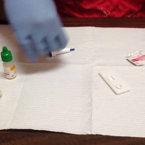 Image of HIV Rapid Test on the table
