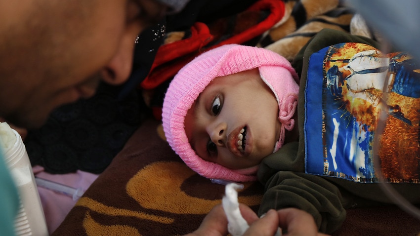イエメンの50万人近くの子供たちが今年飢餓で亡くなる可能性があると国連機関は警告している オーストラリア Kono92 このくに