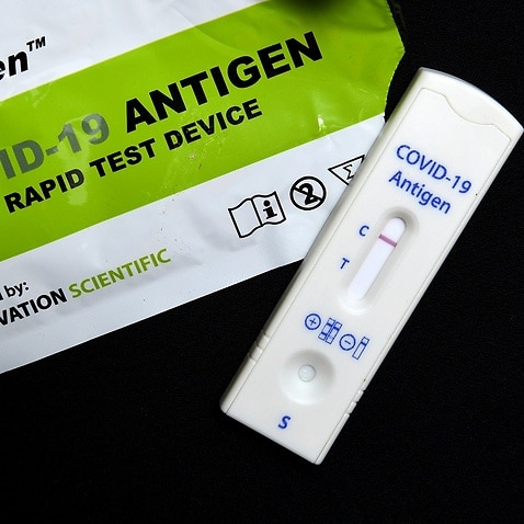 A Rapid Antigen Test (RAT) is a quick test to check if you have COVID-19, a RAT test will provide a result within 15 to 30 minutes. 