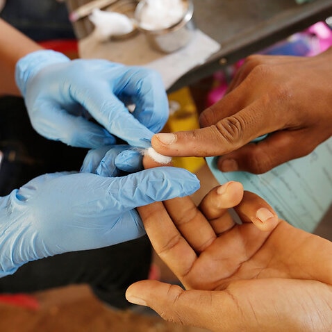 Cambodian health authorities make a blood test on the villagers as they concern about spreading HIV.