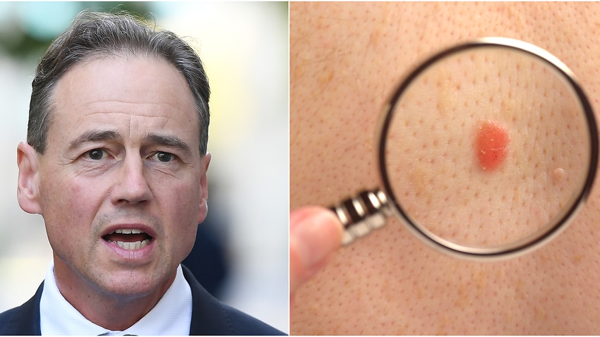 Federal Health Minister Greg Hunt has confirmed more than 2,000 Australians will receive financial relief with two melanoma treatments being added to the PBS.