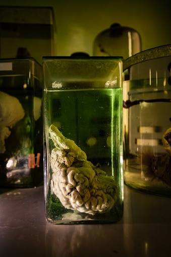 Animal brain in glass jar with formaldehyde