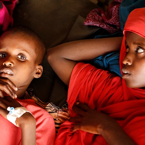 Malnourished children wait for treatment in Somalia