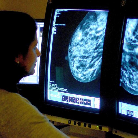 Doctor views breast cancer scan on computer screen