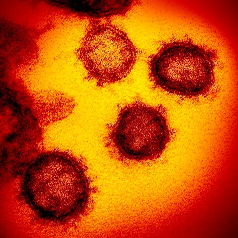 An electron microscope image of the Novel Coronavirus SARS-CoV-2, the virus that causes COVID-19 