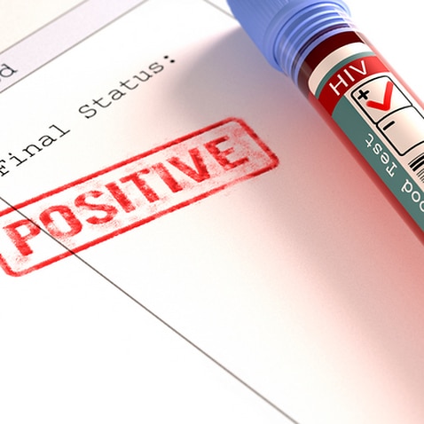 A positive HIV blood test