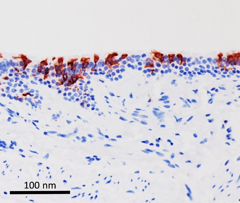 受Omicron病毒感染(呈红色)后的人类支气管组织