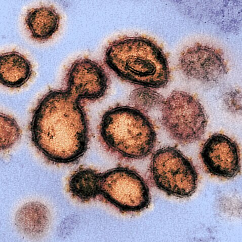 英國科學家正密切關注Delta新冠病毒株的一個最新變種病毒。