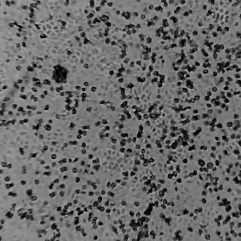 Video image showing the novel coronavirus at Melbourne's Peter Doherty Institute for Infection and Immunity 