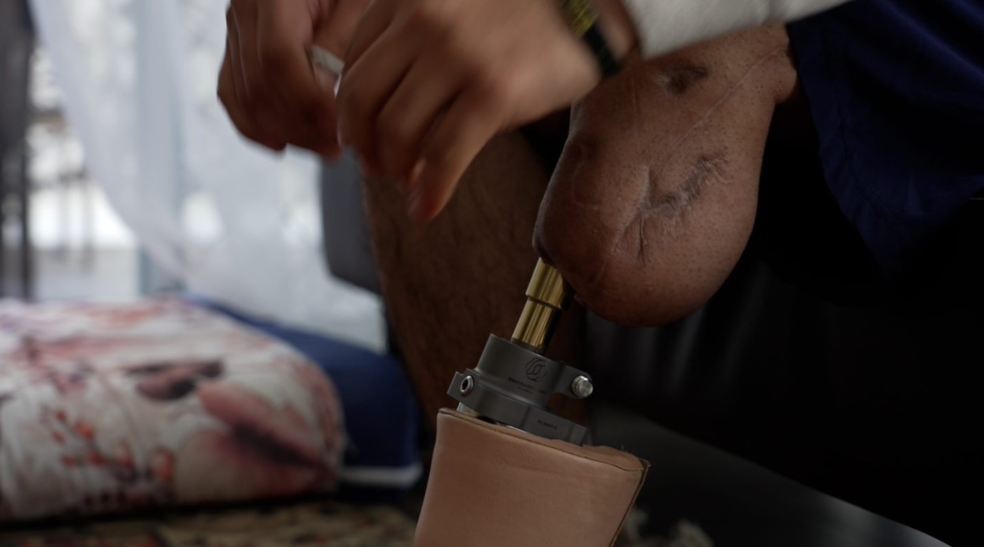 Aminullah lost his left leg in a Taliban ambush before the age of 20.