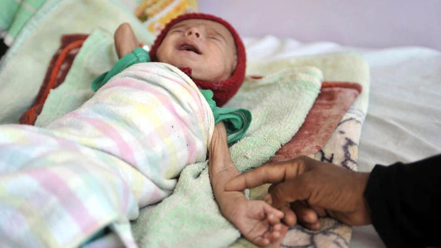 Um bebÃª iemenita desnutrido chora ao deitar-se em uma cama em um centro de alimentaÃ§Ã£o terapÃªutica no Hospital al-Sabaen, em Sanaa, IÃªmen.