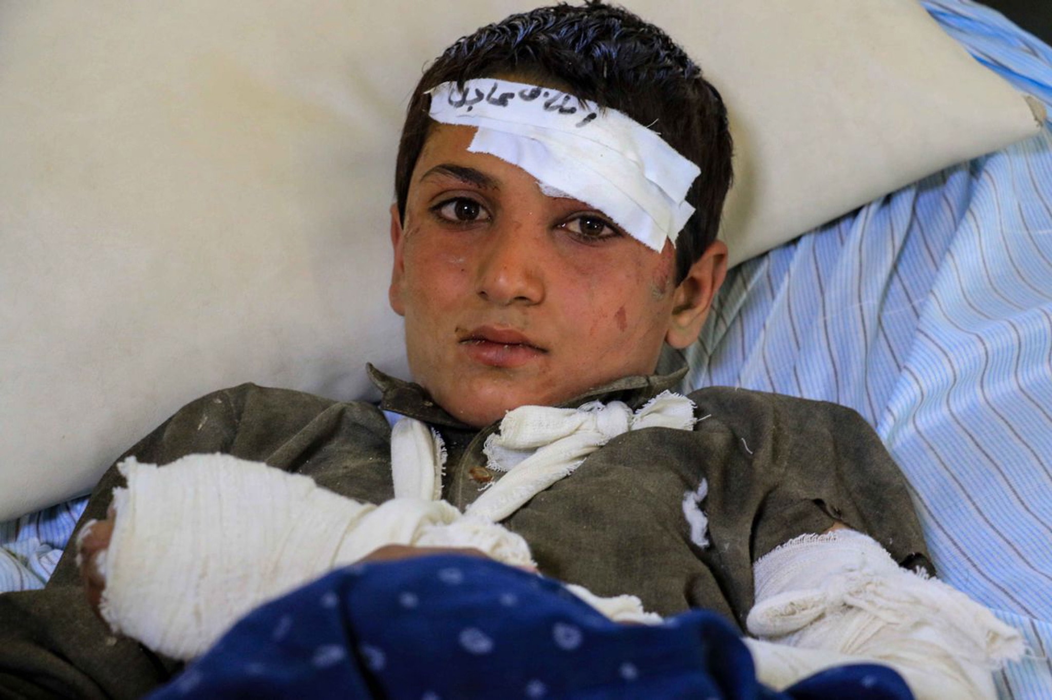 An injured victim of the earthquake receives treatment at a hospital in Paktia, 
