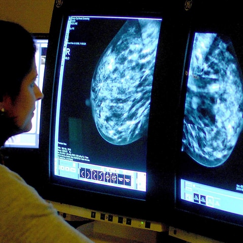 Consultant analyzing a mammogram