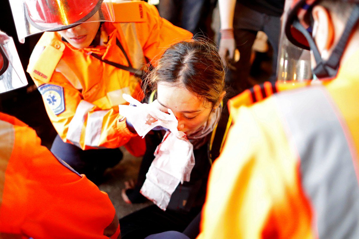 Images of the young woman with a bleeding right eye were circulated among protesters.