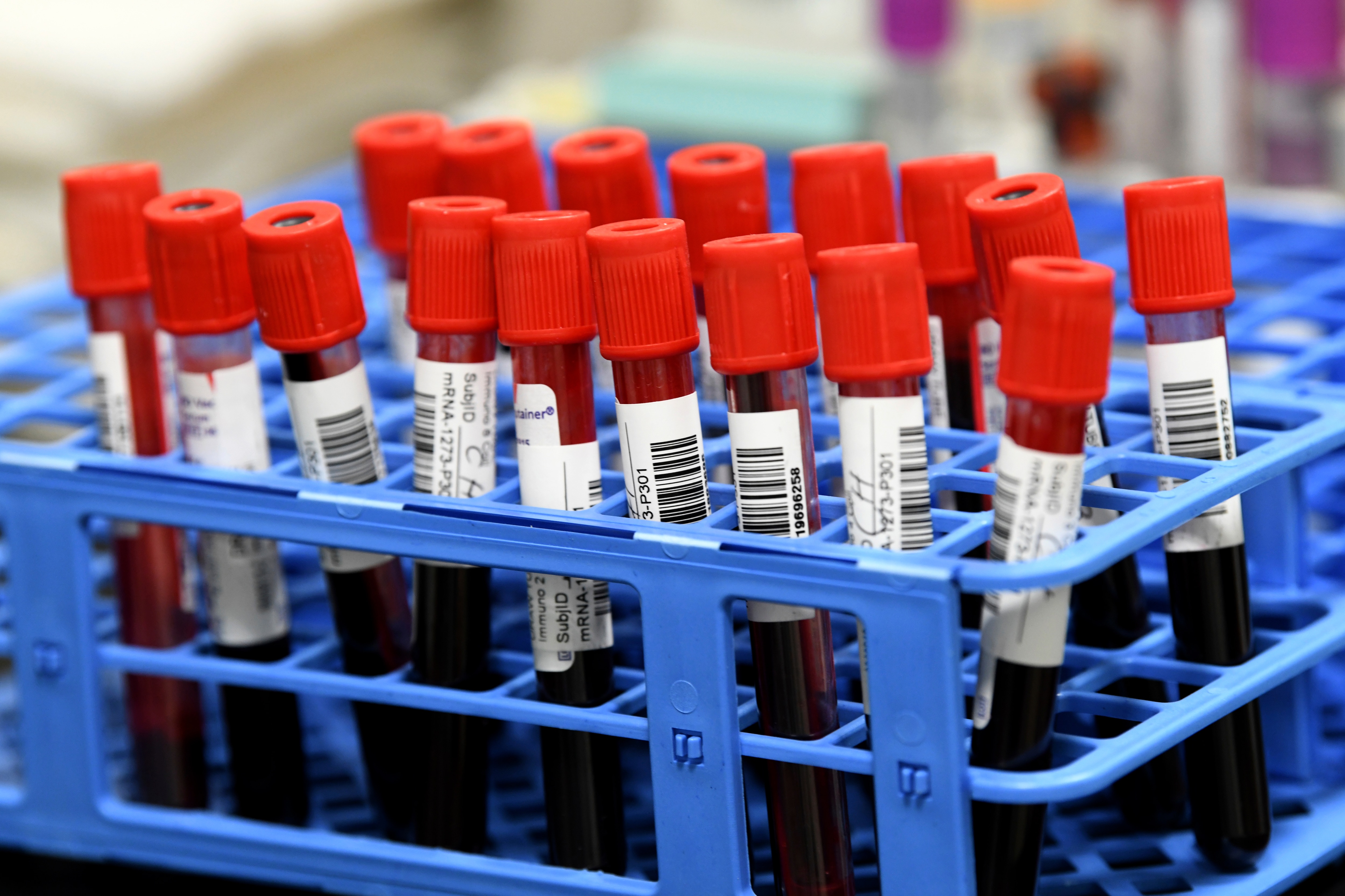 Blood samples from volunteers participating in a phase three vaccine trial at the University of Miami.