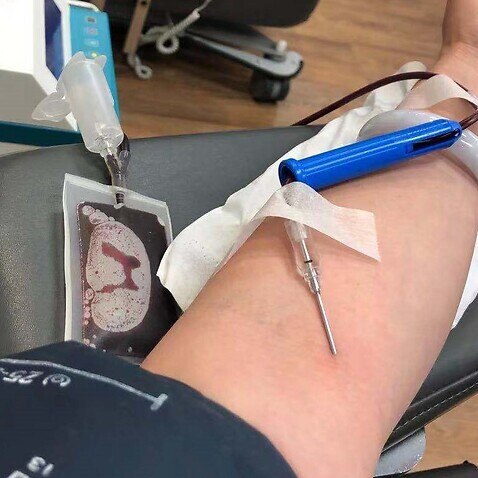 Miki Liu分享献血经历