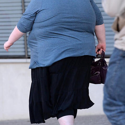 A stock image of a morbidly obese woman in Brisbane, Monday, June 16, 2014. (AAP Image/Dan Peled) NO ARCHIVING
