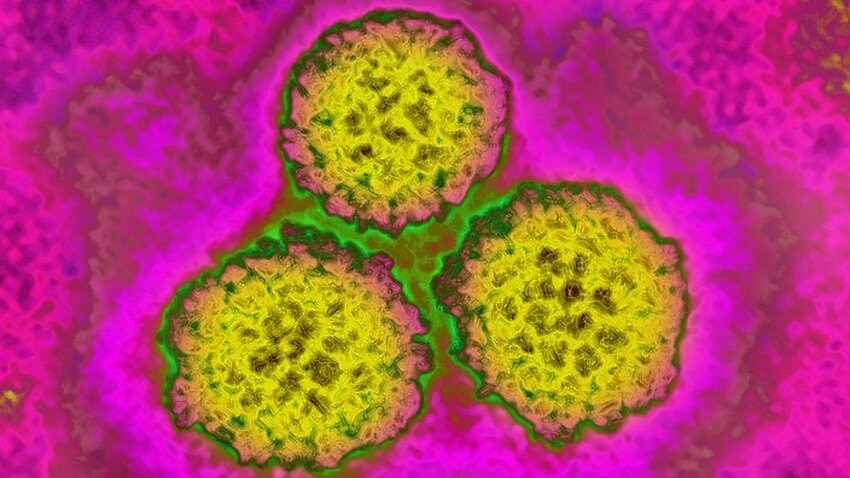 SBS Language | Medical Series: HPV (Human Papillomavirus)