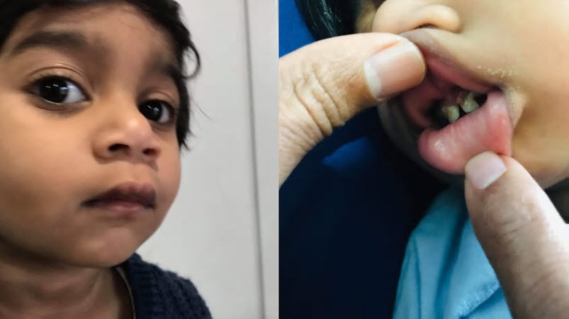 The mother of two-year-old Tamil child Tharnicaa says her repeated requests for dental treatment for her child were dismissed.