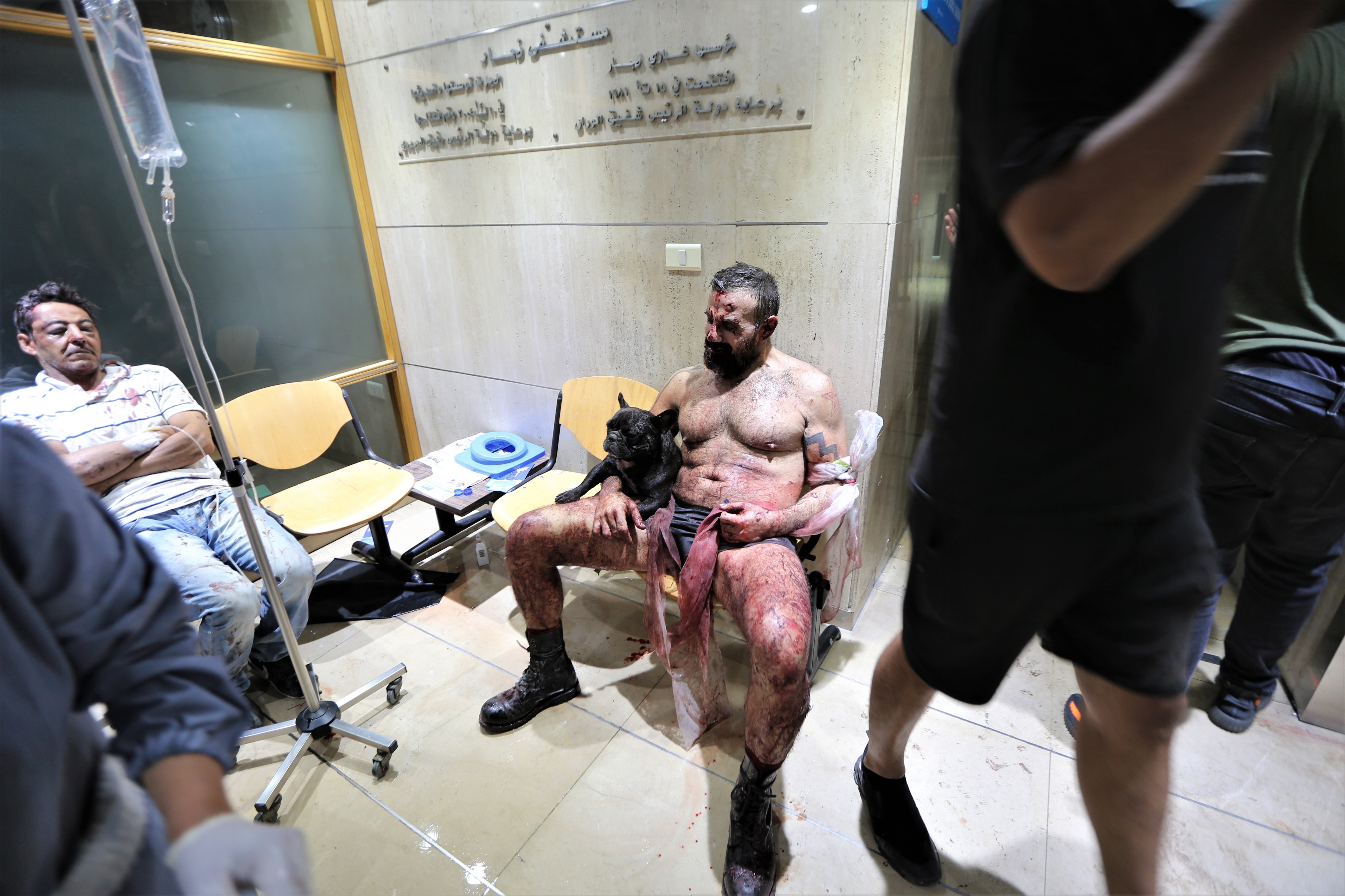 People injured in the Beirut Port explosion receive first aid at Najjar Hospital in Al-Hamra area in Beirut, Lebanon.