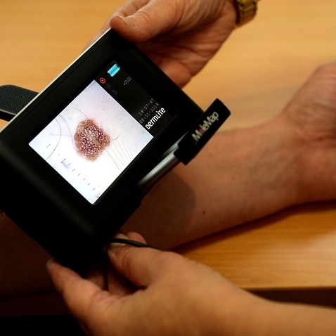 Stock image of a patient being checked for skin cancers at a skin cancer clinic in Sydney