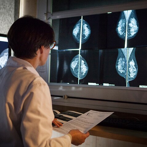 A radiologist looks at the results of mammograms